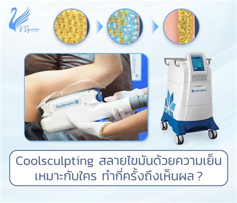 coolsculpting riyadh|10 Best Clinics for CoolSculpting in Thailand [2023 Prices] .